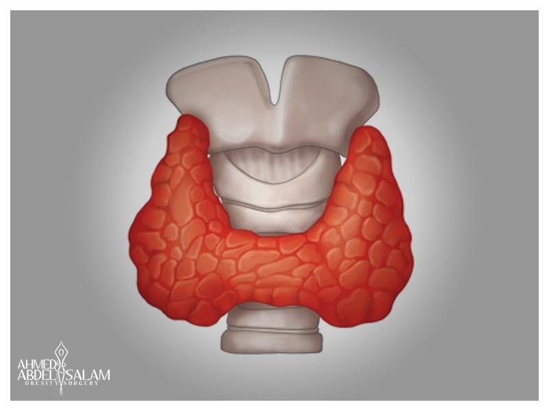 استئصال-الغدة-الدرقية