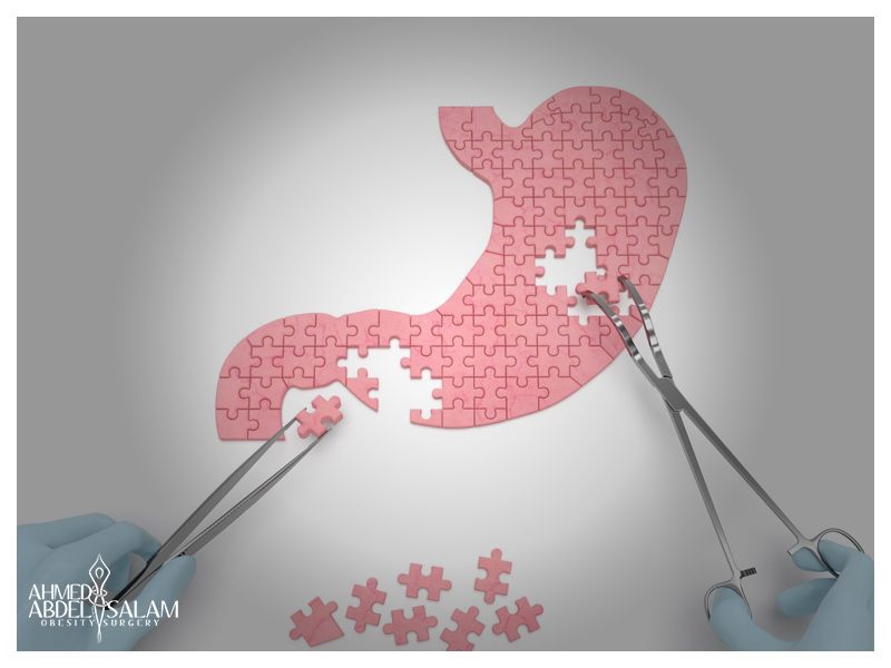 عمليات-التصحيح عمليات-التصحيح