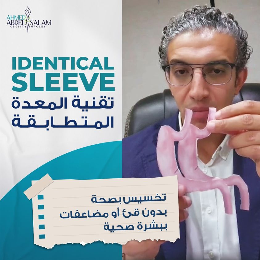 المعدة المتطابقة Identical Sleeve
شكل
