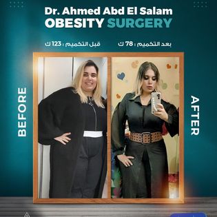 5 مميزات للمعدة المتطابقة Identical Sleeve